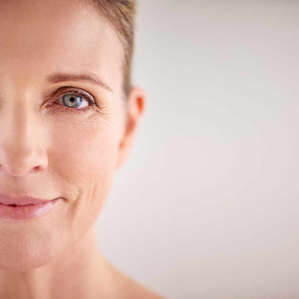 Blefaroplastia