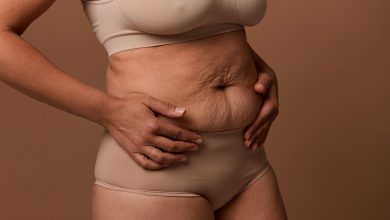Abdominoplastia