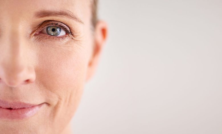 Blefaroplastia