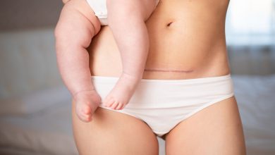 Mommy Makeover
