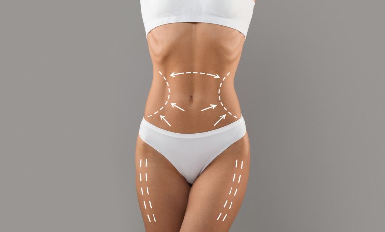 Cirurgia plástica tem risco de trombose ou embolia pulmonar