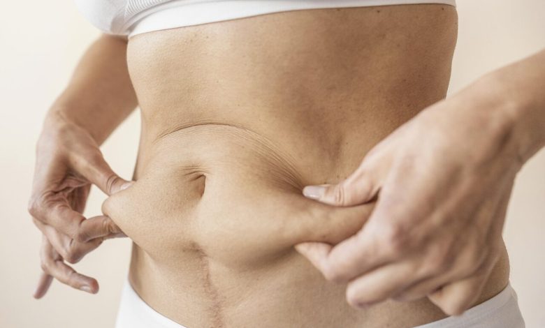 Se o medo da abdominoplastia vem do que você ouviu por aí, este post é pra você.